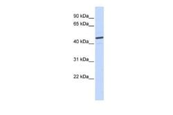 CatSper2 Rabbit anti-Human, Polyclonal, Novus Biologicals 100 &mu;g; Unconjugated:Antibodies,